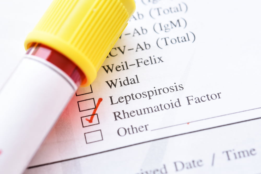 What Elevated Rheumatoid Factor Levels Mean for Your Health