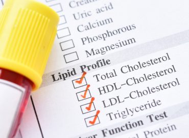 The Role of Stress in Blood Lipid Levels and Heart Disease Risk