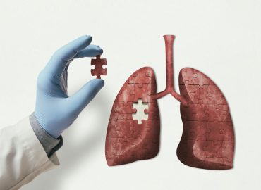 How Lung Health Screenings Can Help Malaysians Quit Smoking