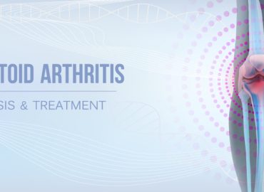 Don't Let Rheumatoid Arthritis Control Your Life: The Importance of Bone Health Screenings