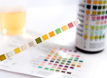 Urine FEME Testing: A Comprehensive Guide for Patients
